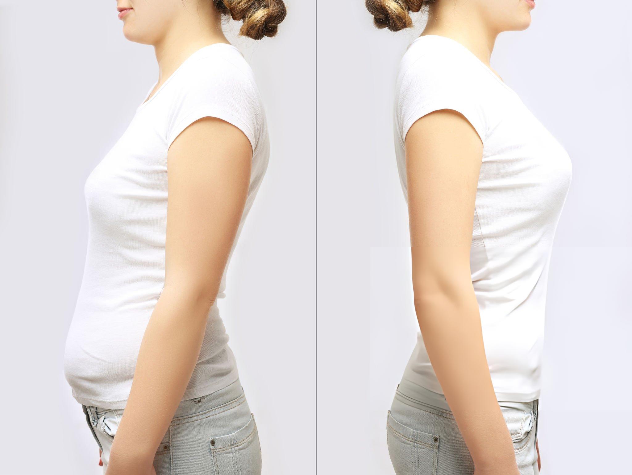 Vaser Liposuction, 2 to 3 Regions | African Medical Services